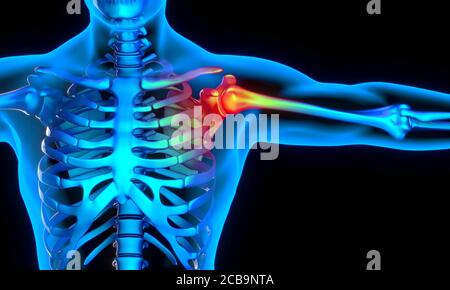 Schulter Problem und Schmerz Konzept. Medizin und Gesundheit. 3d-Rendering. Stockfoto