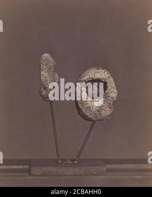 Exkisiertes Kniegelenk. A Round Musket Ball in the Inner Condyle of the Right Femur [Gardiner Lewis, Company B, neunzehnte Indiana Volunteers], 1866-67. Stockfoto