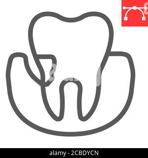 Parodontitis Linie Symbol, Zahn-und Stomatolgie, Parodontalzahn Zeichen Vektorgrafik, editierbare Schlaganfall lineare Symbol, eps 10. Stock Vektor
