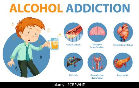 Informationen zur Alkoholabhängigkeit oder Alkoholismus Infografik Illustration Stock Vektor