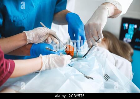 Nahaufnahme Detail einer Operation. Gruppe von Chirurgen bei der Arbeit im Op. Stockfoto