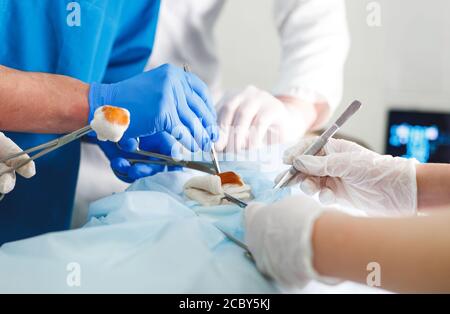Nahaufnahme Detail einer Operation. Gruppe von Chirurgen bei der Arbeit im Op. Stockfoto