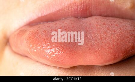 Zungenpapillen schmecken Knospen und Geschmack. Nahaufnahme. Stockfoto