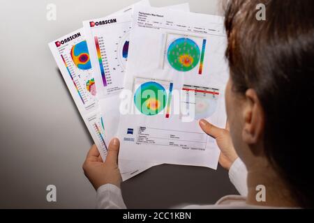 Dünner werdendes Hornhautdystrophie, Augen-Keratotopographie. Stockfoto