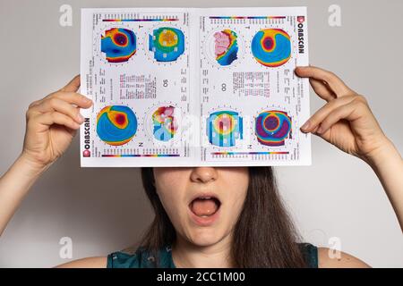 Dünner werdendes Hornhautdystrophie, Augen-Keratotopographie. Stockfoto