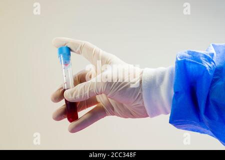 Chemische Laborgeräte, Glaswaren und Pipetten. Tests und Forschungsdiagnosen im Labor. Stockfoto