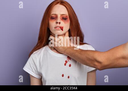 Ingwer Frau mit vielen Prellungen Vorbereitung zu sterben, Nahaufnahme Porträt, Studio-Aufnahme, Lebensstil, schlechte Beziehung zwischen jungen Paar Stockfoto