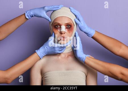 Keine Chance für Falten. Junge Frau in Verbänden mit Prellungen auf ihrem Gesicht Blick auf die Kamera, Mädchen bereitet sich auf die Operation Stockfoto