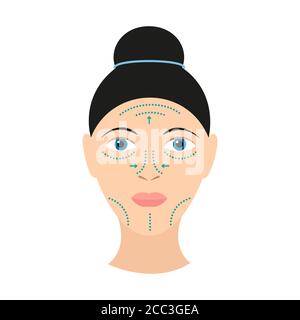 Plastische Chirurgie Markierung Vektor-Illustration in flachem Stil isoliertes Bild Von jungen erwachsenen kaukasischen Frau mit blauen Markierungen auf ihr Gesicht Stock Vektor