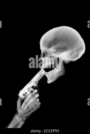 Pistole und Skelett, Röntgen Stockfoto