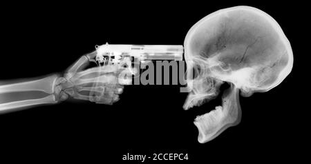 Pistole und Skelett, Röntgen Stockfoto