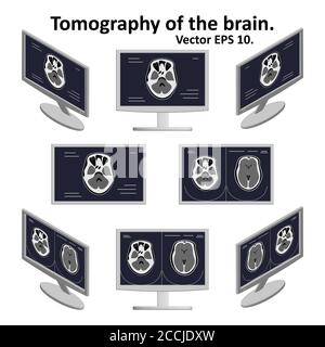 Satz von Querschnitt des Gehirns während der Magnetresonanztomographie auf einem Computerbildschirm in isometrischer Ansicht. Ein paar Bilder vom Bild des Gehirns. Stock Vektor