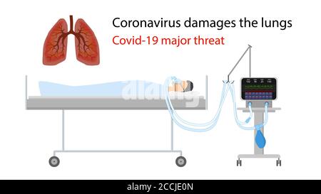 Die größte Bedrohung Coronavirus Lungenschäden. Ein Mann liegt mit einem Ventilator im Bett. Illustration der Lunge mit beschädigten Stellen. Isolierter Vektor EPS10. Stock Vektor
