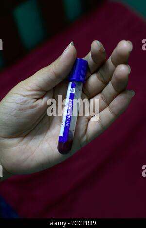 Laborantin, die das Fläschchen oder den Behälter mit Antikoagulanzien mit Blut hält Probe für Tests Stockfoto