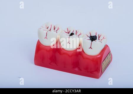 Zahnprothese, Prothesen. Zahnarzthände während der Arbeit an der Prothese auf weißem Tisch Stockfoto