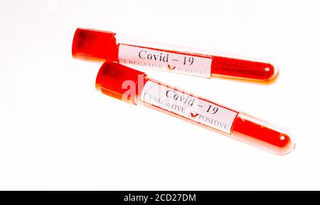 Positive Bluttests für Coronavirus in Reagenzgläsern. Stockfoto