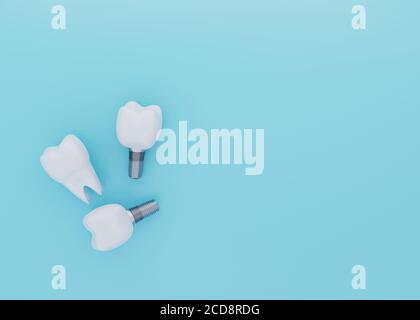 Zahnkrone und Zahnimplantate auf blauem Hintergrund mit Kopierraum, künstlichen Zähnen, 3d-Rendering Stockfoto