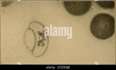 Schlafkrankheit, Trypanosomiasis Parasit Trypanosomen Formen im ...