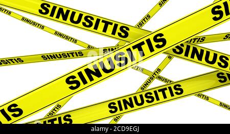 Sinusitis. Gelbe Warnbänder mit schwarzen Worten SINUSITIS (Sinusinfektion oder Rhinosinusitis). Isoliert. 3D-Illustration Stockfoto
