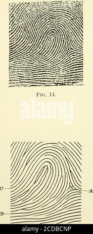 . Klassifizierung und Verwendung von Fingerabdrücken [elektronische Ressource] . nach unten; vergleichen Sie die Abbildungen 35 und 36. Die Abbildungen 28 bis 49 einschließlich zeigen mannigarten Schleifen, und können mitVorteil studiert werden. Ulnar und Radial. – Wenn man es in einem Glas sieht, erscheint die rechte Hand wie eine linke Hand, das Gerechter wie ein linkes Auge, die rechte Hälfte des Körpers wie ein linker. Ähnlich ist der Fingerabdruck ein Widerhall des Musters auf dem Finger; wenn dieses Muster auf dem Finger eine Schleife mit Steigung von links nach rechts ist, erscheint es im Druck als Schleife mit Steigung von rechts nach links. Wenn ein Finger p Stockfoto