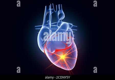 Menschliches Herz mit Koronarararterie und EKG-Kurven Stockfoto