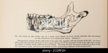 Quains Elemente der Anatomie Col. III veröffentlicht im Jahr 1896, ein Kind Kieferknochen. Stockfoto