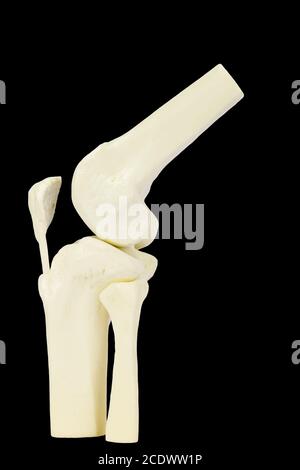Kniegelenkmodell des menschlichen Beins auf schwarzem Hintergrund Stockfoto