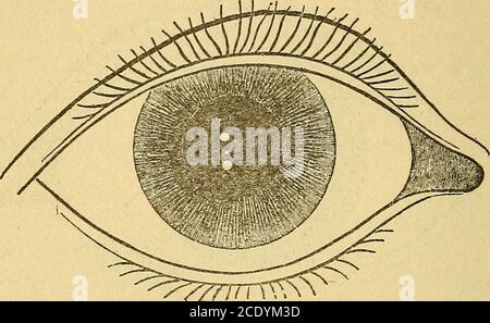 . Physiologische Optik: Als ein Essay beigetragen, um die amerikanische Enzyklopädie der Augenheilkunde. Abb. 33. – Bilder von Purkinje, die mit dem Ophthalmophakometer beobachtet werden, wenn die Linse nicht in Ausrichtung ist.Positionen der Bilder, wenn die beobachtete Person in das Teleskop schaut.Ebene als die Mitte des Teleskoprobjektivs und der Patient wird gebeten, die Mitte des Objektivs zu fixieren. (Lampe und Cursor A, Abb. 31, werden in diesem Experiment entfernt.) Wenn die Oberflächen der Brille alle um die visuelle Linie zentriert würde es sechs Bilder 77 PHYSIOLOGISCHE OPTIK durch Reflexion auf dem sam gesehen werden Stockfoto