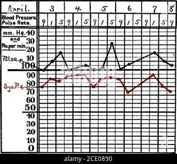 . Die klinische Studie des Blutdrucks : ein Leitfaden für die Verwendung des Sphygmomanometers in der medizinischen, chirurgischen und geburtshilflichen Praxis, mit einer Zusammenfassung der experimentellen und klinischen Fakten im Zusammenhang mit dem Blutdruck in der Gesundheit und bei der Krankheit . Gued eine schlechte Prog-nosis. 3. CHRONISCHE INFEKTIONSKRANKHEITEN A. Tuberkulose. – die frühesten Studien von Marfan führten ihn zu der Tatsache, dass niedrige Spannung eines der beständigsten Symptome von Phthisis ist, das selbst im Anfangsstadium auftritt. Von einem gehun-dred Patienten, nur drei zeigten normalen Druck, und die beiden alten Menschen mit Arterio-Sklerose. Sein unqualifizierter Staat-m Stockfoto