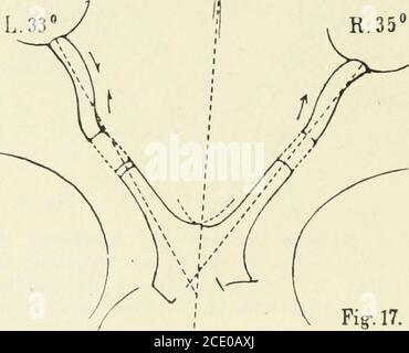 . Beiträge zur Anatomie der Orbita . Augapfel. Werden die bulbi nach innen-unten rotiert, so wird der Sehwert nicht ganz gestreckt. Wird der obliquus Superior bei Ruhelage des Auges angeschrieben, so wird der Bulbus nach oben und innen rotiert, dabei wird die eine-Trittsstelle des Sehnerven ein klein wenig nach oben-innen gezogen. Wird der obliquus angezogen, wenn der Bulbus vorher nach innen-unten geführt war, so wird jetzt die Tnsertionsstelle des Sehnerven einklein nach oben-innen gezogen, links mehr wie rechts. An dem hinteren Bulbusabschnitt links erscheint die Papille vielleicht Stockfoto