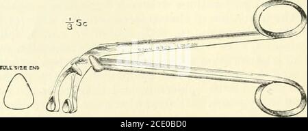 . The Journal of Laryngology and otology . thor schaut uponligation der inneren jugulären Vene als manchmal notwendig; mostautors scheinen zu stimmen, dass es im Allgemeinen notwendig ist, und dass die Casesin, in denen es verzichtet werden könnte, sind außergewöhnlich. Professor Mac-ewens bemerkenswert erfolgreiche Reihe von Fällen, jedoch gehen stark zu unterstützen die Autoren Ansichten. Kapitel xxxv. Befasst sich in beträchtlichem Detail mit den lokalen und allgemeinen Neigungen, die Störungen des Hörens verursachen können, einschließlich Diph-Therie, Scharlach, Masern, Grippe, etc. Ausreichend wurde gesagt, um den Wert der Arbeit zu zeigen, die Stockfoto