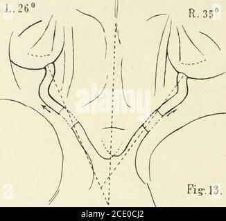 . Beiträge zur Anatomie der Orbita . nn etwas nach innen und gleichzeitig etwas nach oben, schließlichnach oben-aussen (bezeichnet zur Bulbusoberfläche inserierend). The into the inside to the Bulbus a Torsionvon innen nach aussen statthabe. L.: Im Canal. Opt. Ziemlich hori-zontal nach aussen und vorn. Nach Australien aus demselben anfangsannähernd die gleiche Richtung beibehalten, dann steil aufsteigen,zuletzt horizontal gerade nach vorn zum Bulbus. Werden die bulbi nach innen-unten rotiert, so werden die sehnerven knapp gestreckt, aber ?iicht gezerrt. Die Papille Stockfoto