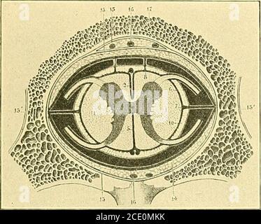 . Einige Punkte in der Operation des Gehirns und seiner Membranen. i DER HIRNMEMBRANEN 51 bestimmte Sorten Eiter scheinen butLittle Tendenz zu perforieren serous Membranen (wie die Arachnoid oder Peritoneum) und butLittle irritierende Wirkung auf sie zu haben. Der Eiter kann in einem Blatt größer oder weniger dick- ausgebreitet. Stockfoto