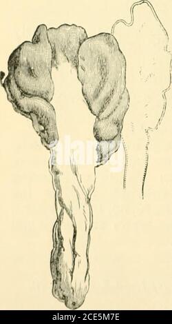 . Guide to Sowerby's Modelle der britischen Pilze in der Abteilung für Botanik, British Museum (Natural History) . Abb. 76. – Leotia schmierenPers. (Natürliche Größe.) 184. Mitrula cuuUata Fr. - Receptacleovate, Globose, oder Mitrate, sogar, gelblich-rot oder eisenhaltig, AP-proaching schwarz; stalkslander, fest, gerade, oder tomentose nach unten, fl e X U o U s, dunkler als recep-tacle oder braun-schwarz.Grows gregariouslyon Verfall Pineleaves im Herbst. Abb. 77, Fr.. Stockfoto