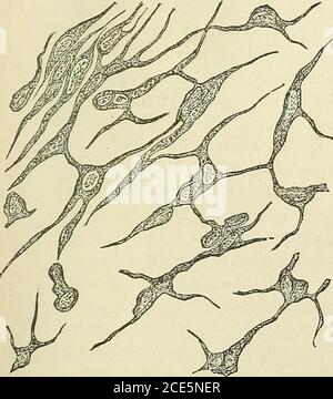 . Allgemeine chirurgische Pathologie und Therapeutik, in einundfünfzig Vorlesungen .. . Zellkugeln aus dem Asarkom des Duramaters. Magnified350 Durchmesser. Abb. 136. Abb. 1. Stockfoto