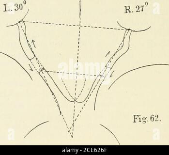 . Beiträge zur Anatomie der Orbita . all etwas, da es nicht ausgemacht ist, wo-durch Hornhautflecken relativ häufig zu Refraktionserhöhungführen. Ist es nur die durch den Hornhautfleck bedingte Schwach-Sichtbarkeit, welche eine verstärkte Annäherung an das BetrachteteObjekt nötig macht oder kommt dem Hornhautfleck auch noch die Bedeutung zu, dass er den Flüssigkeitsaustritt durch die Horn-haut dauernd – wenn auch nur in gereintem Grade ? 126 III Group (Nr. 62-88.) Kurzes Abrollstück (5,5 mm gross und kleiner). Weihen movements of the auges will be more oderless stark Stockfoto