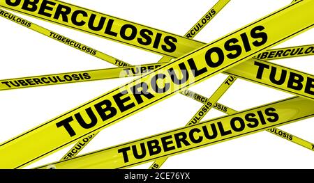 Gelbe Warnbänder mit schwarzen Worten TUBERKULOSE (ist eine Infektionskrankheit, die normalerweise durch Mycobacterium tuberculosis-Bakterien verursacht wird). Isoliert Stockfoto