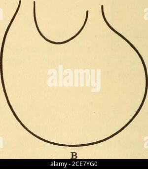 . Dr. Evans' wie man gut hält; . Abb. 86. – rückwärtsgewölbter AC-Wert der Skoliose. Korrektur der Skoliose. Abb. 87. – deutliche Schrumpfung von LeftLung aufgrund postpneumonischer EM-physiema. Wiederherstellung des normalen pe-Rimeters in drei Monaten durch Übungen. Eine Behandlung ist gefordert, die wichtigsten Dinge zu tun sind hygienisch. Die Zugaben sind, Milchwechsel – um sie reiner und reicher zu machen; etwas Stärke und Zucker aus der Ernährung fallen lassen; um bessere häusliche Bedingungen zu schaffen. Das sind die Dinge, die getan werden müssen – und das bedeutet medizinische Leitung. Goingfirst zu einem Arzt für eine Flasche Medizin, und dann zu an Stockfoto