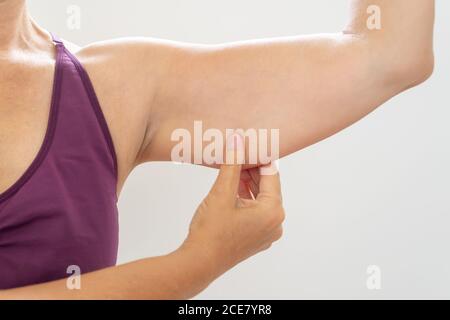 Reife Frau kneifen schlaffen Arm, Körperpflege und Fitness-Konzept Stockfoto