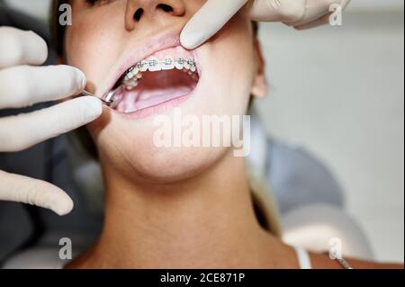 Von oben Ernte unkenntlich weibliche Zahnarzt in Handschuhen mit Spiegel, um Zähne von Frau mit Zahnspangen während der Arbeit in der zeitgenössischen Klinik zu überprüfen Stockfoto