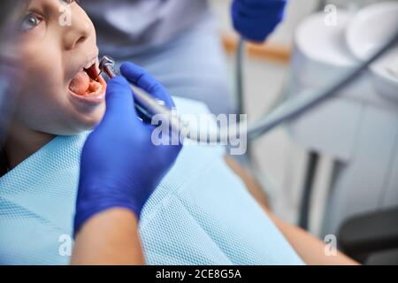 Haselaugen-Kind Öffnung Mund weit für die zahnärztliche Behandlung Stockfoto