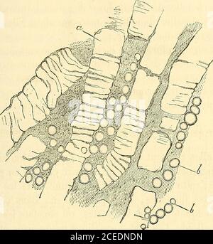 . Manuel d'histologie experimentale. pli Abb. 32. – Coupe de deux tubes urinifères kystiiues remplis de matière colloïde a, au Milieu de laquelleon voit des cylindres hyalins de même nature 6, 6. – Grossissement de 100 diamètres. plis par une substance colloïde quon peut voir naître aux dépensdes cellules épithéliales des tubuli. Ceux-CI se dilatent et se trans-forment en kystes dont le Centre est occupé par une Masse colloïdefestonnée à ses bords et montrat des cellules en train de subir cettedégénérescence, comme dans le Corps thyroïde. DÉGÉNÉRESCENCE VITREUSE DES MUSCLES. 71 Les cylindres Stockfoto