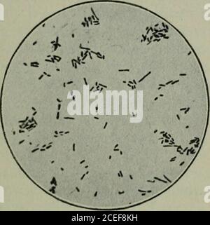 . Pathogene Mikroorganismen, einschließlich Bakterien und Protozoen; ein praktisches Handbuch für Studenten, Ärzte und Gesundheitsbeauftragte. Ceda hat einen Wert in der Behandlung. Impfstoffe. – Diese haben sich nicht als wertvoll erwiesen. INFLUENZA UND PSEUDOINFLUENZA-BAZILLEN. 359 DER KOCH-WOCHEN BACILLUS DER KONJUNKTIVITIS. Dieser Bazillus wurde erstmals von R. Koch im Jahr 1883 beobachtet, während er bestimmte Untersuchungen zur Entzündung des Auges vorsah, die während einer Choleraepidemie in Alexandria auftrat. Es wurde später, im Jahr 1887, moralisch beschrieben durch Weeks^ in New York. Wochen erhielt es inreine Kultur im Jahr 1890. Die Infecti Stockfoto