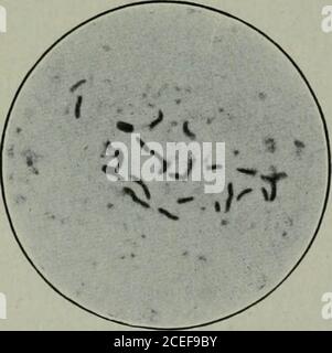 . Pathogene Mikroorganismen, einschließlich Bakterien und Protozoen; ein praktisches Handbuch für Studenten, Ärzte und Gesundheitsbeauftragte. Und pathogene Eigenschaften. – Es wurden zahlreiche Versuche unternommen, den Bazillus von Lustgarten auf künstlichen Medien zu kultivieren, aber mit zweifelhaftem Erfolg. Die Einimpfungen von Tieren haben auch nur Negativeresulte gegeben. Ijustgartens bacillus wurde gefunden, infarious syphilitic Gewebe und Läsionen, beginnende Sklerose, in den Papeln, in con-dylomata und gummata, und nicht nur in der Nähe der Genitalien, sondern auch in den Forellen, Hals, Herz und Gehirn. Keine Satis-Factory Exp Stockfoto