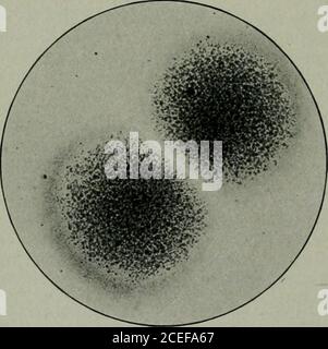 . Pathogene Mikroorganismen, einschließlich Bakterien und Protozoen; ein praktisches Handbuch für Studenten, Ärzte und Gesundheitsbeauftragte. r work die einzige Variante war, dass im ursprünglichen Rezept der Agar hinzugefügt wurde, wenn die Gelatine in die Dose gegeben wurde, jetzt wird die gela-Dose nach der ersten Filtration hinzugefügt. Das Capaldi-Medium wird normalerweise für Oberflächenkulturen eingesetzt, kann aber inokuliert werden, während es in Thetubes geschmolzen wird. Platten können vorhand gemacht werden, so dass sie für die Verwendung mit dem Probenkomesin bereit sind. Da diese Platten bei 37 Grad Celsius liegen sollen, werden die Schwierigkeiten in Bezug auf die Temperatur vermieden, aber im Gegensatz zum Eis Stockfoto