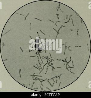 . Pathogene Mikroorganismen, einschließlich Bakterien und Protozoen; ein praktisches Handbuch für Studenten, Ärzte und Gesundheitsbeauftragte. Erhitzte Milch die gleiche Bac-Terie wie in Maadzoun vorkommen. Yohoud, blabberade, und andere saure Milch werden durch die Verwendung vonmuch die gleichen Organismen hergestellt. Die Bazillen sind derzeit am meisten interessant sind diejenigen, die den B.bulgaricus (B. von Massol), die in der östlichen Milch vorhanden sind und sind jetzt durch die Befürwortung von Metchnikoff allein oder in Verbindung mit einer Milchsäure Streptokokken verwendet, um viel von der Tschindung der Milch von Europa und Amerika zu produzieren. In H)()(t, Cohendy studierte Stockfoto