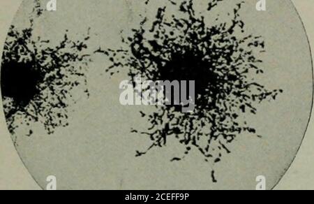 . Pathogene Mikroorganismen, einschließlich Bakterien und Protozoen; ein praktisches Handbuch für Studenten, Ärzte und Gesundheitsbeauftragte. Und es entstehen fieberige Kolonien. Während sich in der früheren Methode (gegossene Platte) die meisten Bakterien unter der Oberfläche entwickelten, entwickeln sich hier alle. Dies ist ein Vorteil, da sich viele Bakterienformen charakteristischer auf der Oberfläche entwickeln als in der Mitte des Mediums, und es einfacher ist, sie mit der Platinnadel frei von anderen Bakterien zu entfernen. Anstatt das Material mittels des Platindrahtes über dem Agar zu Streifen, kann eine Schlupflücke auf dem Agara abgelegt werden Stockfoto