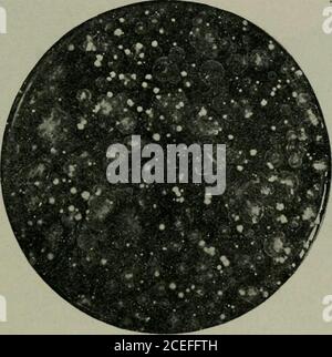. Pathogene Mikroorganismen, einschließlich Bakterien und Protozoen; ein praktisches Handbuch für Studenten, Ärzte und Gesundheitsbeauftragte.Mployed produzieren natürlich keine Kolonien.Nährstoffgelatine wird genau als Agar verwendet, außer dass das Durchschnittsprodukt erst bei Abkühlung unter 22 Grad Celsius kongiert.Wir haben keine Angst vor seiner Abkühlung zu schnell. METHODEN^ IN DER KULTIVIERUNG VON BAKTERIEN VERWENDET. 71 um nicht nur die Anzahl der Kolonien zu zählen und ein charakteristisches Wachstum zu erzielen, sondern auch um die Hemmung des Wachstums einiger und die Fusing anderer zu verhindern, ist es wünschenswert, den Nährstoff Agar oder gela nicht zu inokulieren Stockfoto