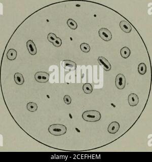 . Pathogene Mikroorganismen, einschließlich Bakterien und Protozoen; ein praktisches Handbuch für Studenten, Ärzte und Gesundheitsbeauftragte. Die Farbe der Iolette ist für das Nakedeye sichtbar. Es kann dann in Wasser gewaschen und untersucht werden, oder vor dem Examinieren kann es für ein paar Minuten durch eine Schwächelösung eines Kontrastfarbstoffs, wie Eosin, Fuchsin, Karmin oder bis-marck braun kontern gefärbt werden. Diese Methode ist nützlich, um die Kapselnaufzuzeigen, die einige Bakterien umgibt – insbesondere die Pneumo-Kokken – und auch bei der Unterscheidung zwischen verschiedenen Bakterienarten, die forsome tun und andere ihren Fleck nicht behalten Stockfoto