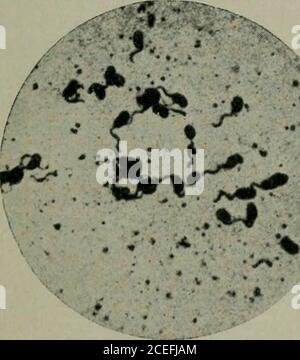 . Pathogene Mikroorganismen, einschließlich Bakterien und Protozoen; ein praktisches Handbuch für Studenten, Ärzte und Gesundheitsbeauftragte. H die gewöhnlichen Farbstoffe, wird dann gefärbt und deutlicher sichtbar, als es üblich ist. Gelegentlich, wie immer, bleibt ein Teil der Hülle unbefleckt, wenn die flagellapresent das Aussehen von vom Körper der Bakteriaby eine schmale Zone gelöst. In gefärbten Kulturen von reich flagellierten bakteriapeculiaren plissierten Massen manchmal beobachtet werden, bestehend aus flagella, die gelöst und dann zusammen verfilzt wurden. Bakterien können ihre Macht verlieren Stockfoto